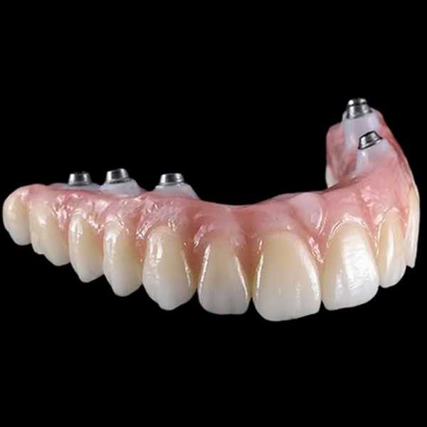 Protese-Dentaria.jpg